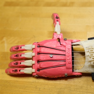 Global Prosthetic Project Making... Tuesday, July 21, 2015